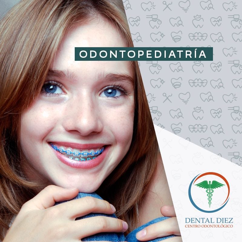 Ortodoncia - Implantesdentaldiez.com